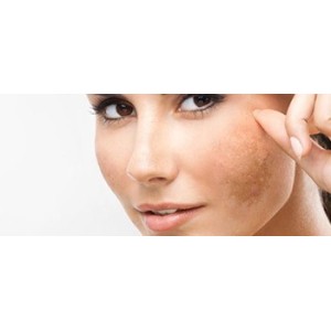 Anti-taches brunes du visage
